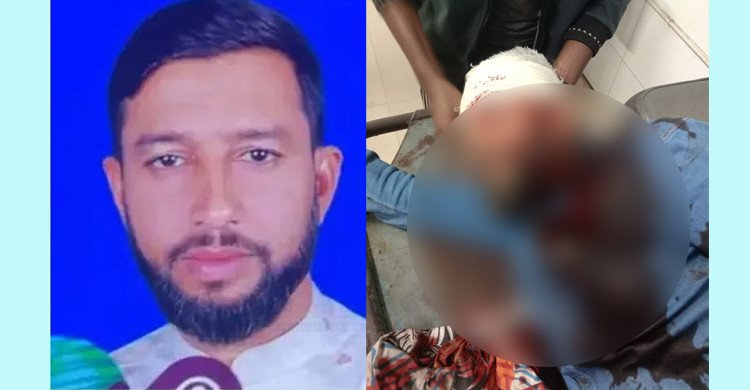 এনসিপি খুলনা বিভাগীয় আহ্বায়ককে মাথায় গুলি